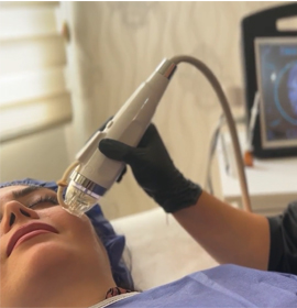 ویدئو مراحل کامل انجام آر اف فرکشنال